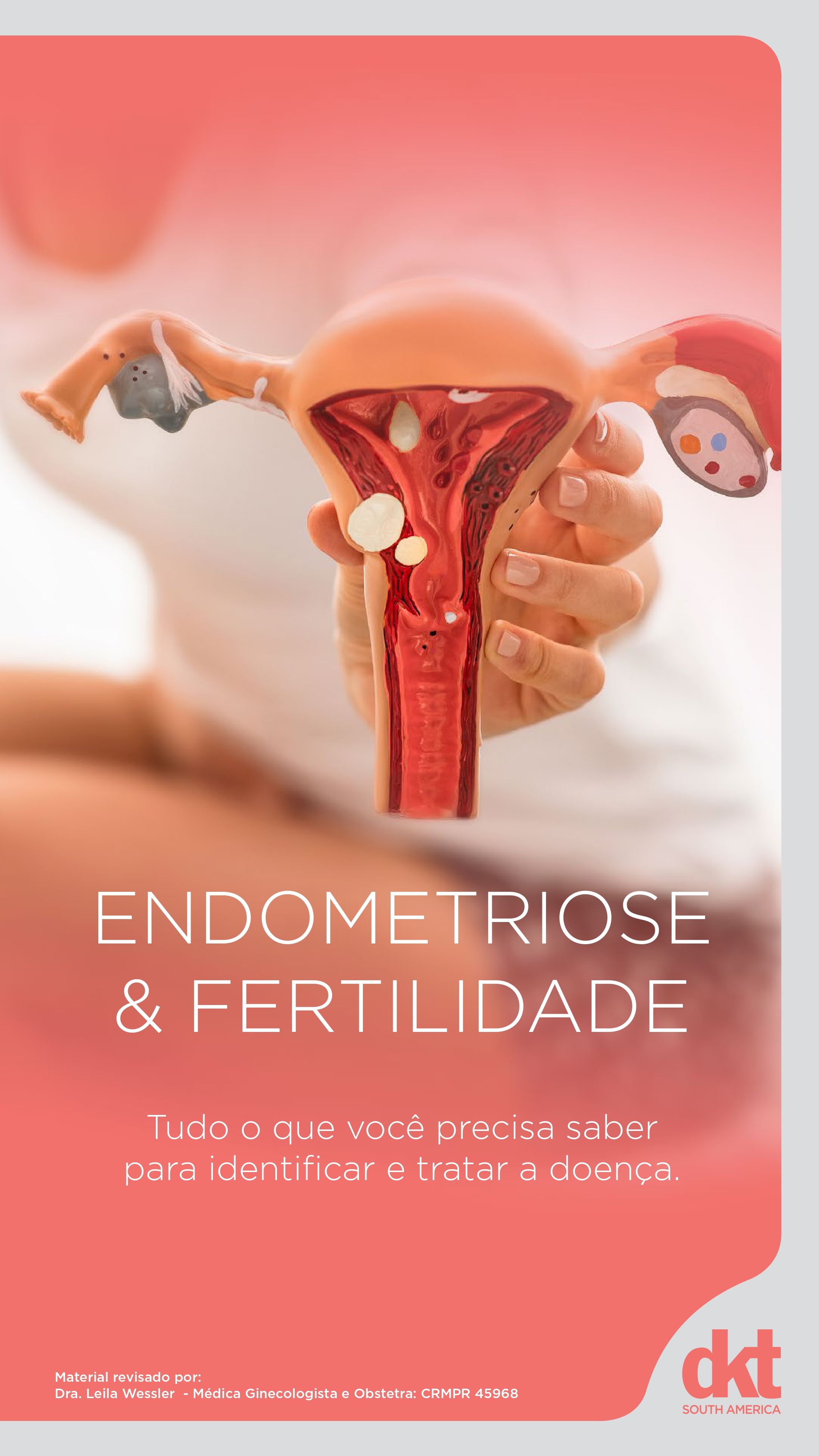 Endometriose e Fertilidade